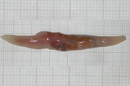 flukes are one of the common species of worms that can infect a human body