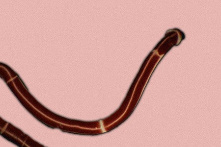 ribbon worms are amongst the slimmest ones of all types of worms