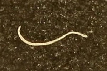 threadworms are different worms that can produce transparent eggs