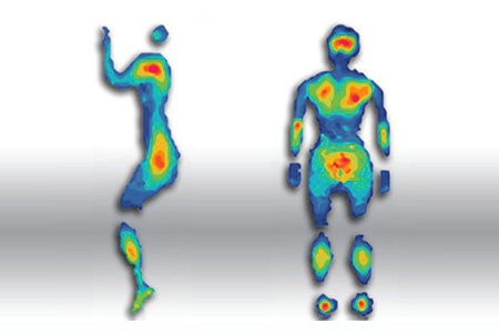 body pressure points from sleeping on a chair that effect blood circulation