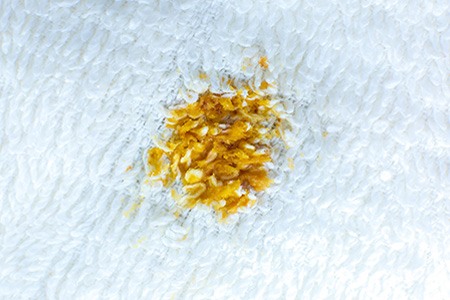 there are other frequently asked questions other than "how to remove turmeric stains on carpet", here you can find answers to all of them