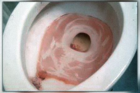 one of the reasons for brown water in the toilet is a rusty toilet!